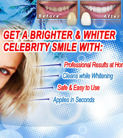 Idol White - Teeth Whitening - Vancouver